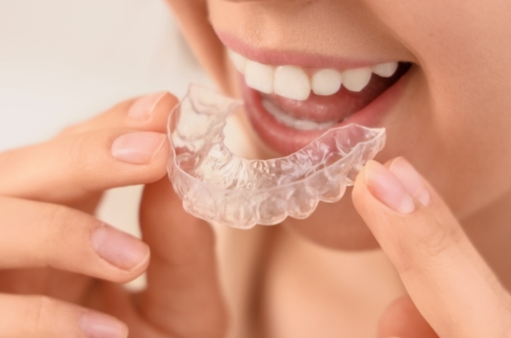 Aligners
