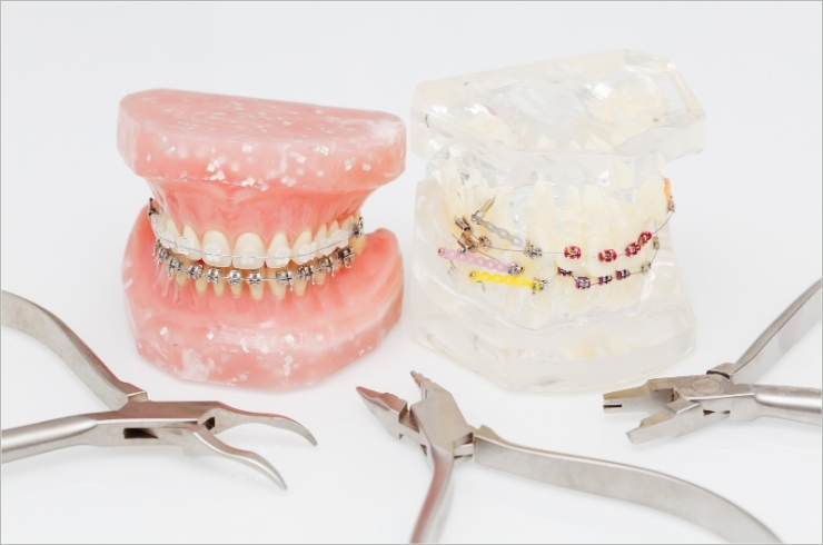orthodontics